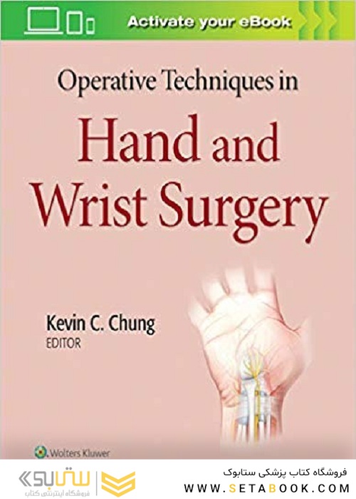 Operative Techniques in Hand and Wrist Surgery