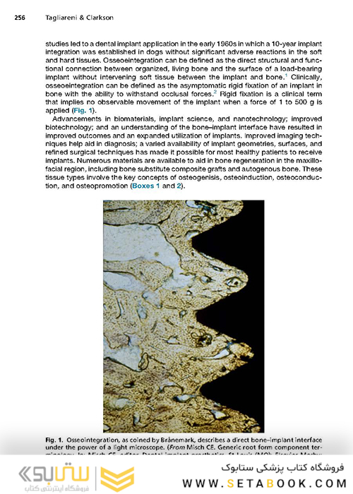 Implant Procedures for the General Dentist, An Issue of Dental Clinics of North America