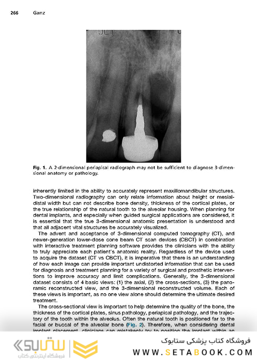 Implant Procedures for the General Dentist, An Issue of Dental Clinics of North America