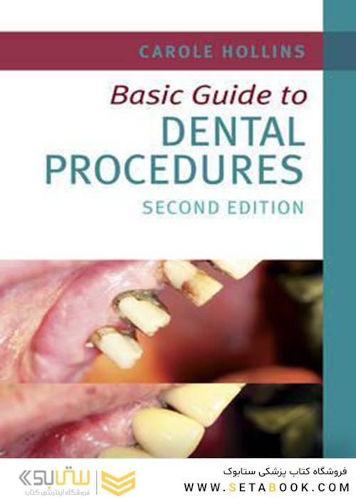 Basic Guide to Dental Procedures