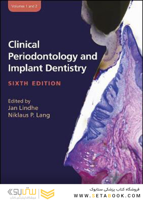 Clinical Periodontology and Implant Dentistry, 2 Volume Set