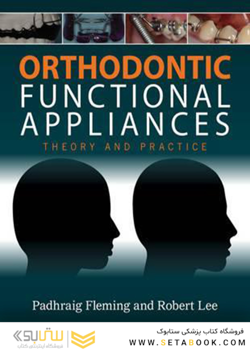 Orthodontic Functional Appliances : Theory and Practice