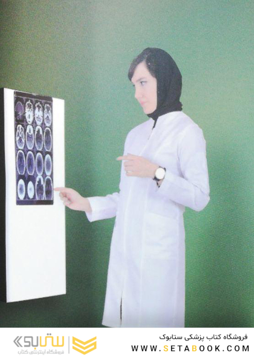 روپوش یقه ایستاده زیپ دار