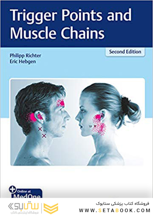 Trigger Points and Muscle Chains