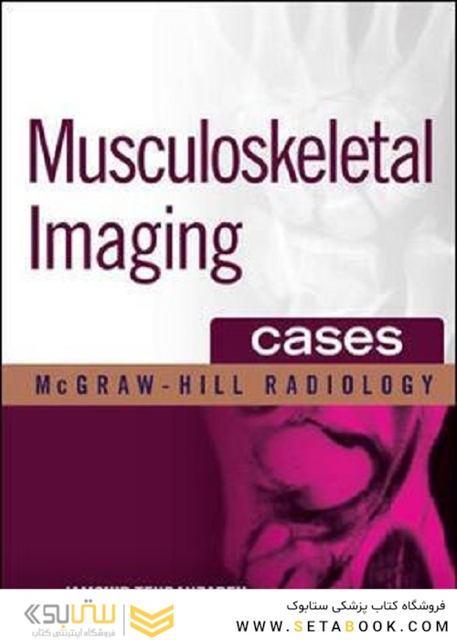  تصویربرداری عضلانی و اسکلتی اسکلت Musculoskeletal Imaging Cases 