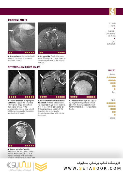 تصویربرداری عضلانی و اسکلتی اسکلت Musculoskeletal Imaging Cases 