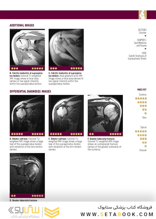  تصویربرداری عضلانی و اسکلتی اسکلت Musculoskeletal Imaging Cases 