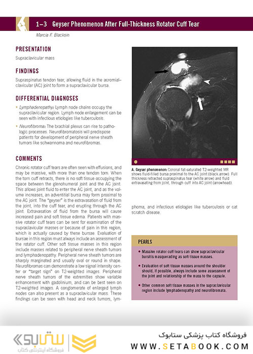  تصویربرداری عضلانی و اسکلتی اسکلت Musculoskeletal Imaging Cases 