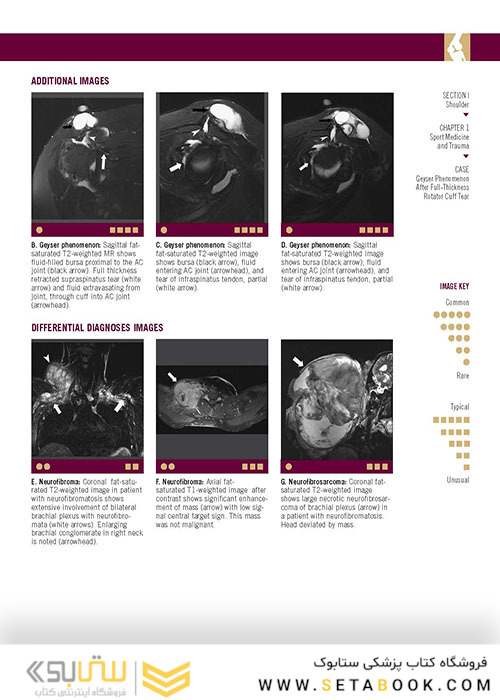  تصویربرداری عضلانی و اسکلتی اسکلت Musculoskeletal Imaging Cases 