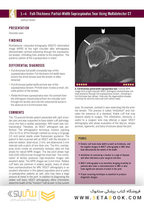  تصویربرداری عضلانی و اسکلتی اسکلت Musculoskeletal Imaging Cases 