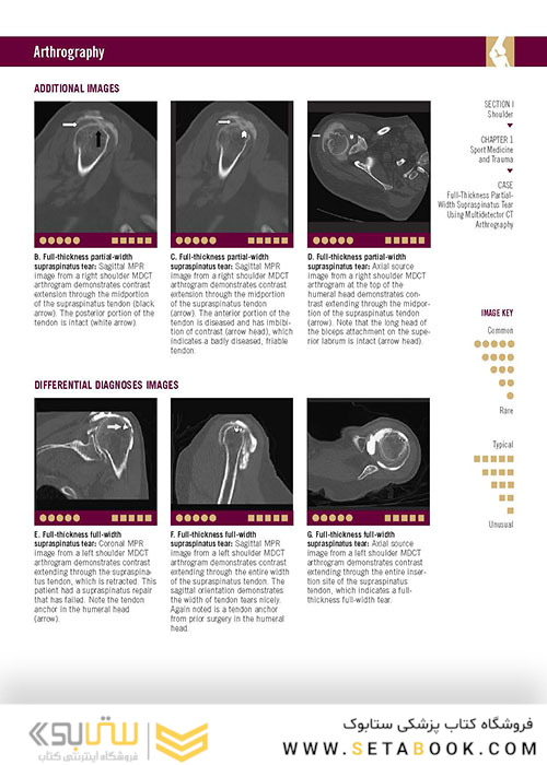  تصویربرداری عضلانی و اسکلتی اسکلت Musculoskeletal Imaging Cases 