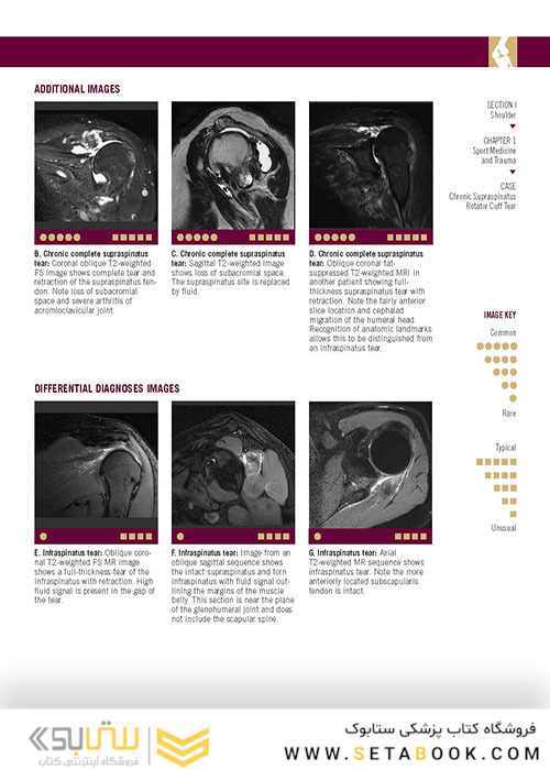  تصویربرداری عضلانی و اسکلتی اسکلت Musculoskeletal Imaging Cases 