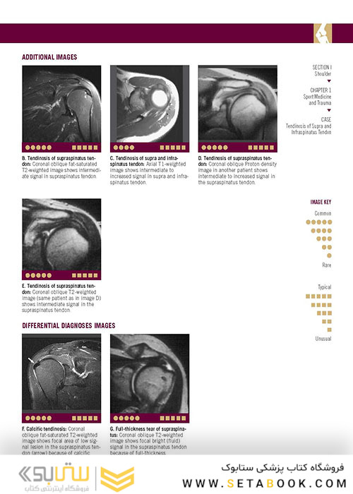  تصویربرداری عضلانی و اسکلتی اسکلت Musculoskeletal Imaging Cases 