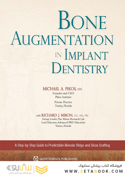 Bone Augmentation in Implant Dentistry: A Step-by-Step Guide to Predictable Alveolar Ridge and Sinus Grafting 1st Edition 2019