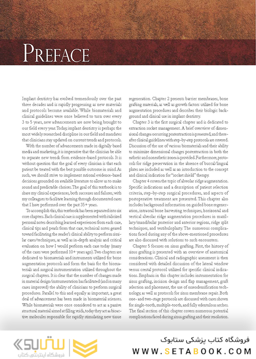 Bone Augmentation in Implant Dentistry: A Step-by-Step Guide to Predictable Alveolar Ridge and Sinus Grafting 1st Edition 2019