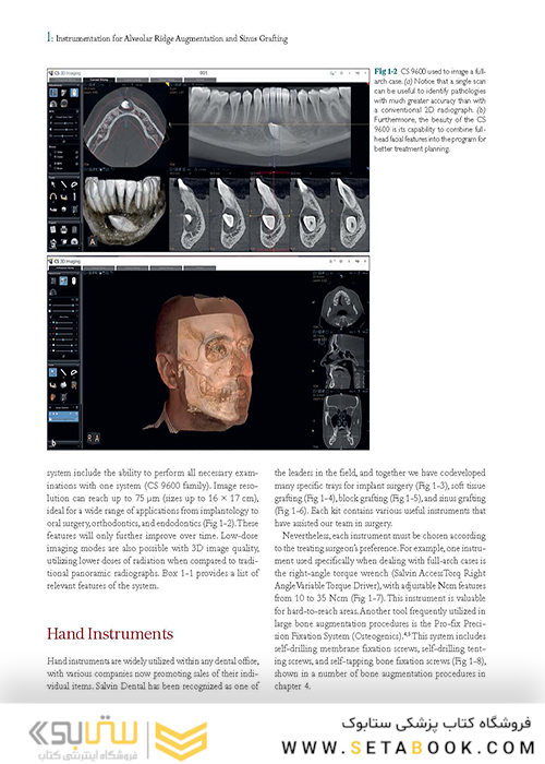 Bone Augmentation in Implant Dentistry: A Step-by-Step Guide to Predictable Alveolar Ridge and Sinus Grafting 1st Edition 2019
