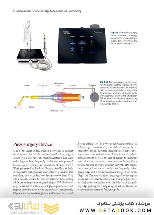 Bone Augmentation in Implant Dentistry: A Step-by-Step Guide to Predictable Alveolar Ridge and Sinus Grafting 1st Edition 2019