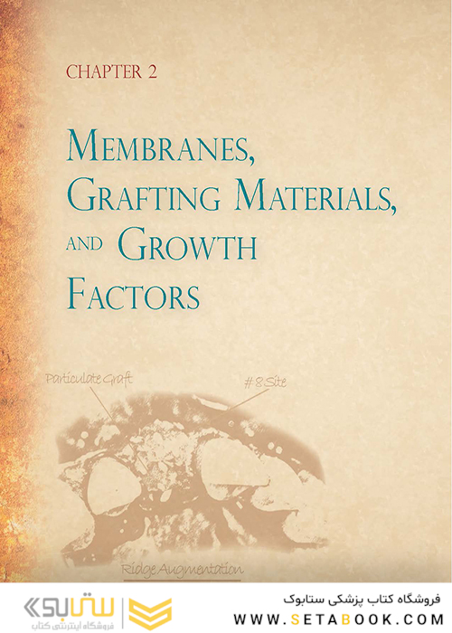 Bone Augmentation in Implant Dentistry: A Step-by-Step Guide to Predictable Alveolar Ridge and Sinus Grafting 1st Edition 2019