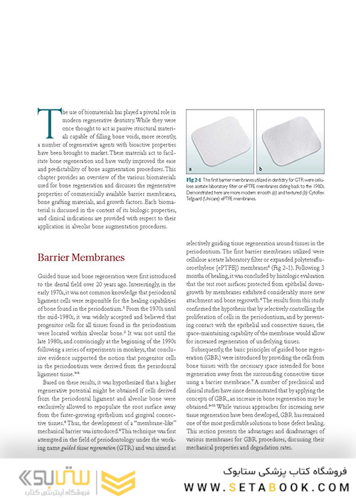 Bone Augmentation in Implant Dentistry: A Step-by-Step Guide to Predictable Alveolar Ridge and Sinus Grafting 1st Edition 2019