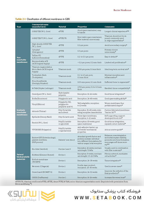Bone Augmentation in Implant Dentistry: A Step-by-Step Guide to Predictable Alveolar Ridge and Sinus Grafting 1st Edition 2019