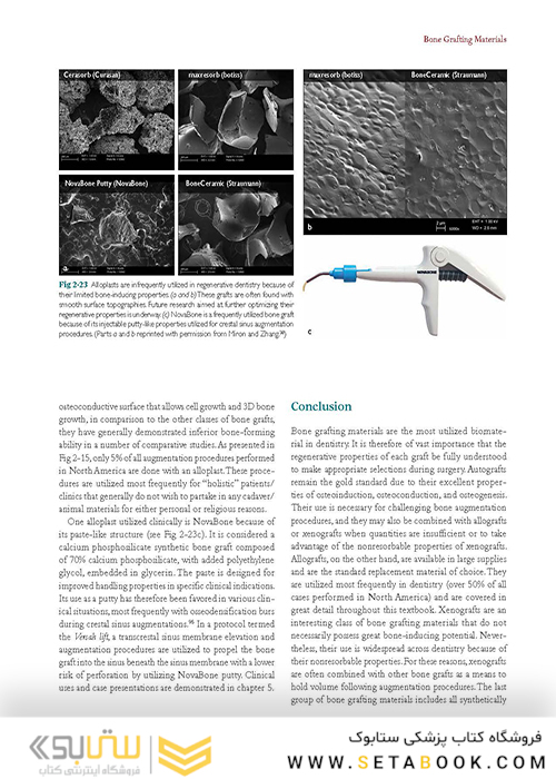 Bone Augmentation in Implant Dentistry: A Step-by-Step Guide to Predictable Alveolar Ridge and Sinus Grafting 1st Edition 2019