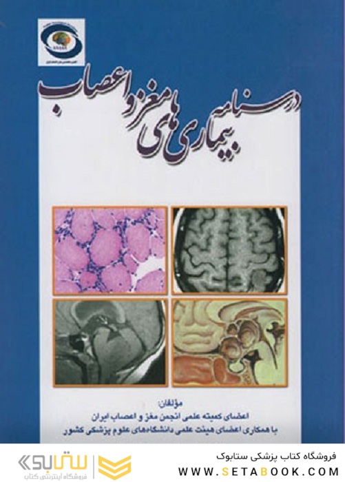 درسنامه بیماری های مغز و اعصاب
