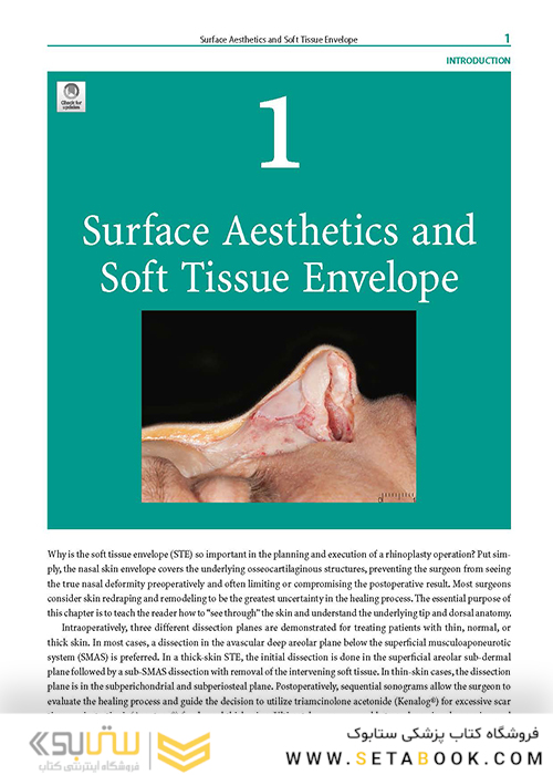 Rhinoplasty: An Anatomical and Clinical Atlas 1st ed Edition 2018