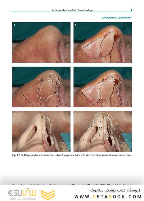 Rhinoplasty: An Anatomical and Clinical Atlas 1st ed Edition 2018