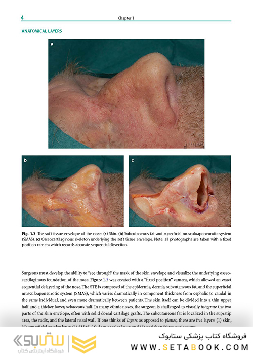 Rhinoplasty: An Anatomical and Clinical Atlas 1st ed Edition 2018