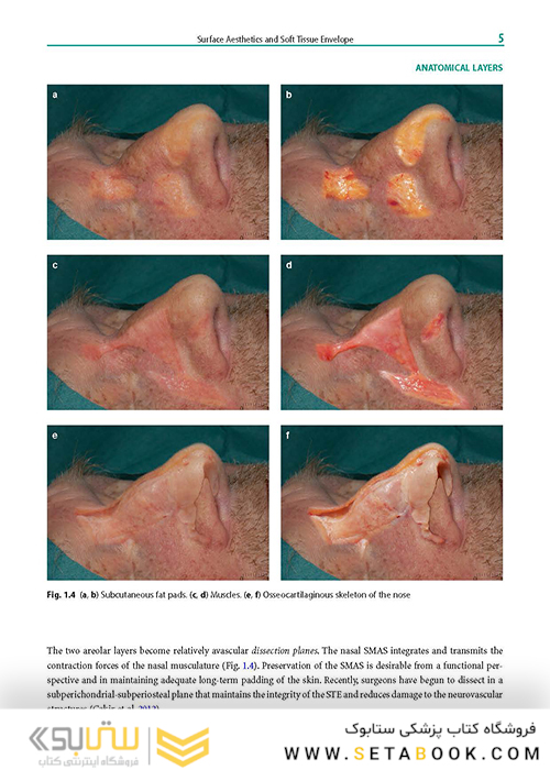 Rhinoplasty: An Anatomical and Clinical Atlas 1st ed Edition 2018