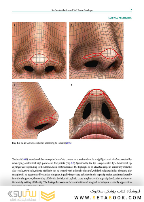 Rhinoplasty: An Anatomical and Clinical Atlas 1st ed Edition 2018
