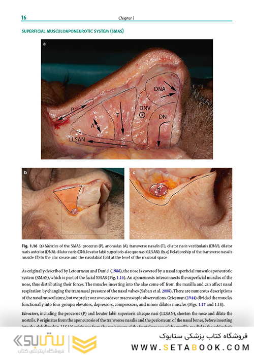 Rhinoplasty: An Anatomical and Clinical Atlas 1st ed Edition 2018