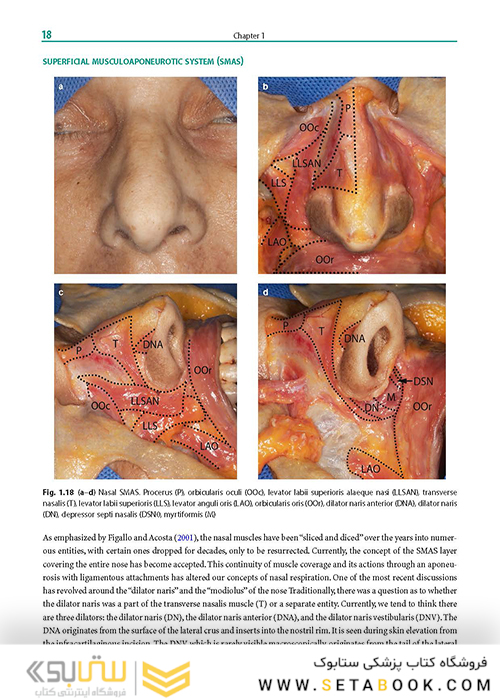 Rhinoplasty: An Anatomical and Clinical Atlas 1st ed Edition 2018