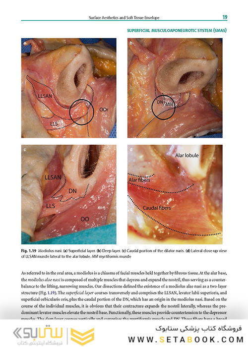 Rhinoplasty: An Anatomical and Clinical Atlas 1st ed Edition 2018