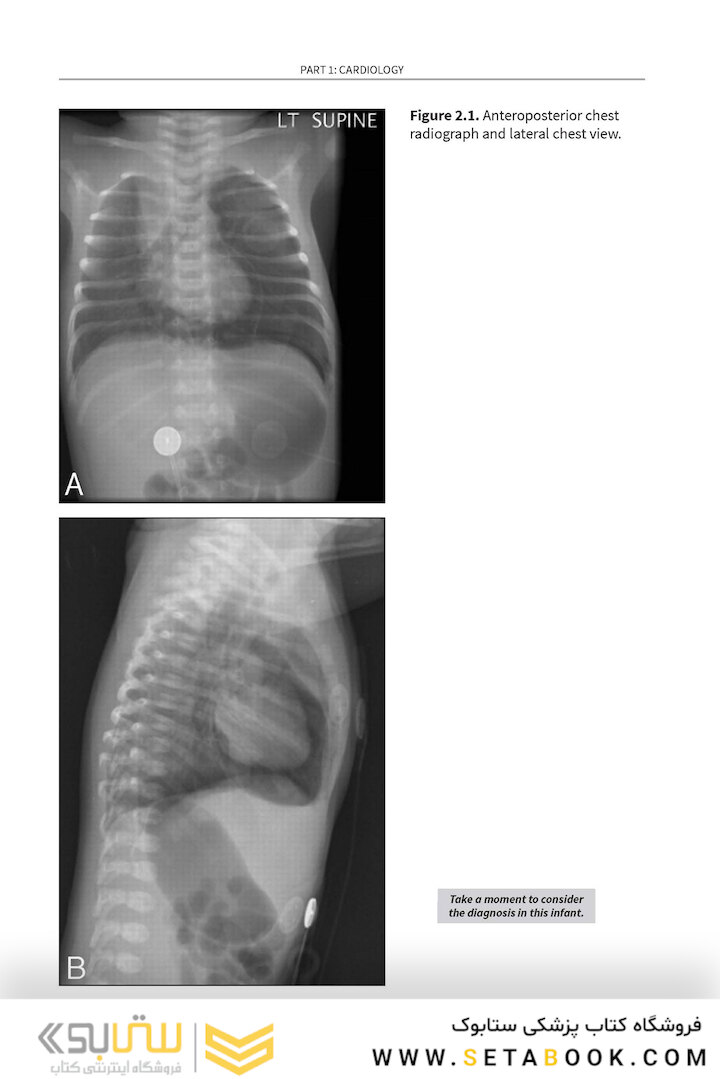 Challenging Cases in Neonatology: Cases from NeoReviews Index of Suspicion in the Nursery and Visual Diagnosis  First Edition 2019