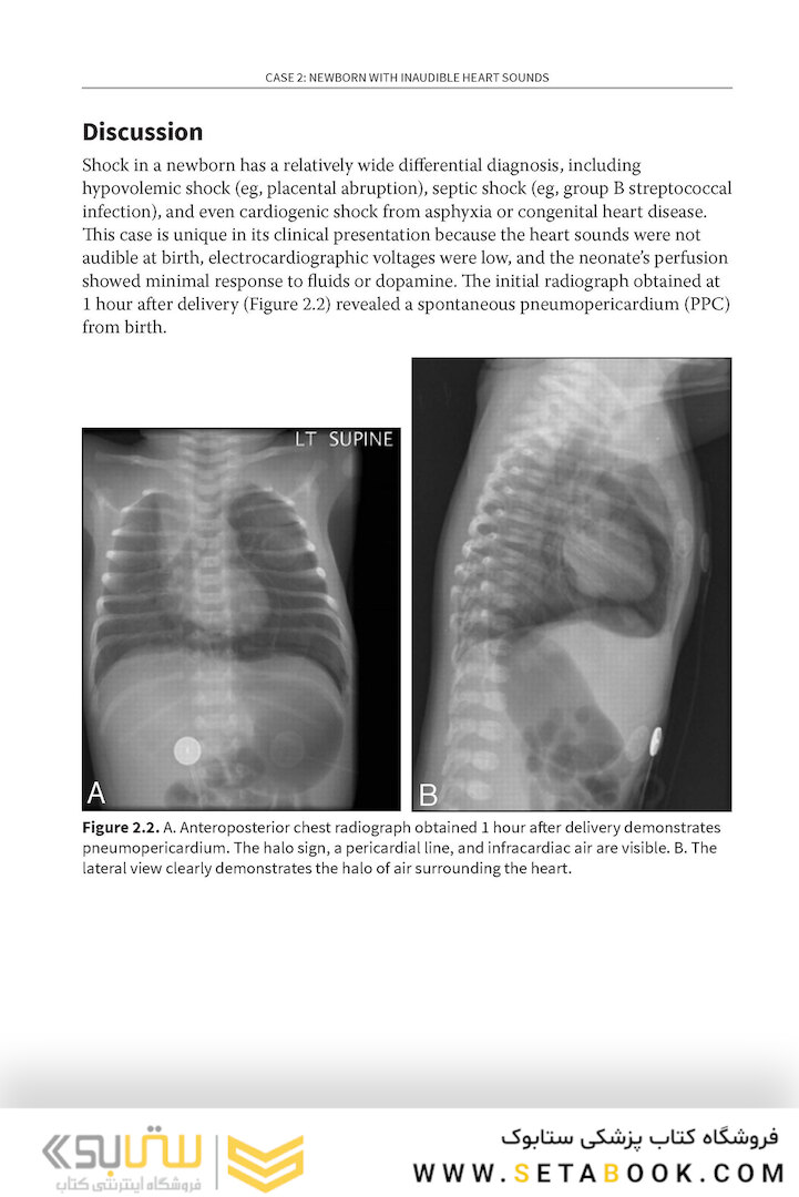 Challenging Cases in Neonatology: Cases from NeoReviews Index of Suspicion in the Nursery and Visual Diagnosis  First Edition 2019