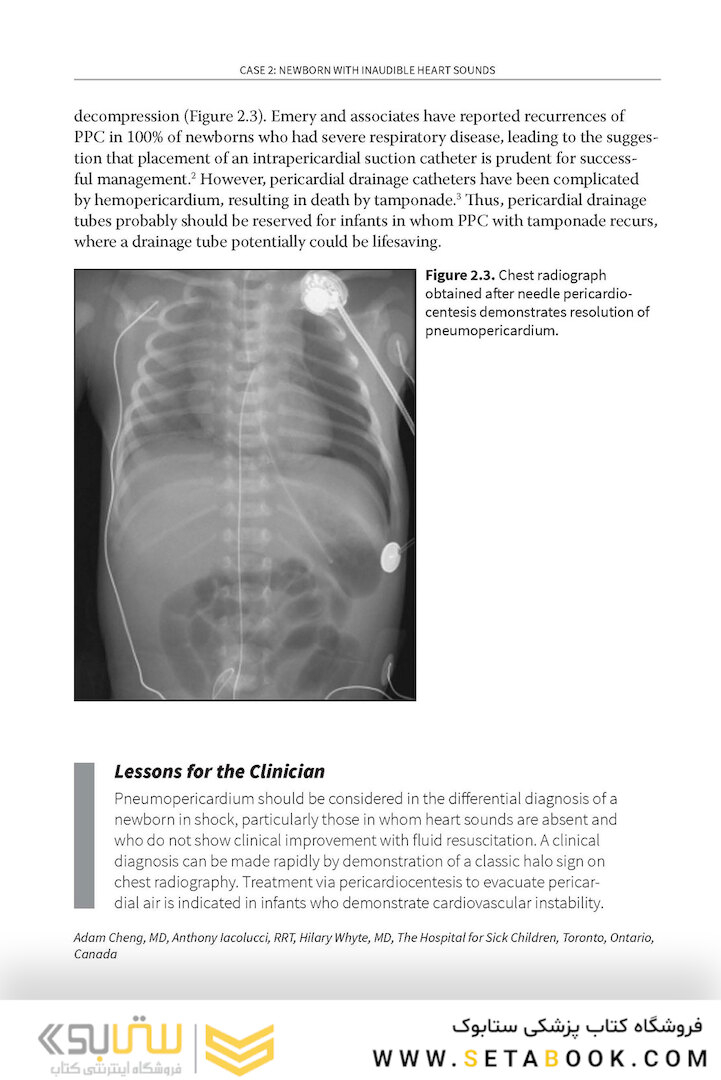 Challenging Cases in Neonatology: Cases from NeoReviews Index of Suspicion in the Nursery and Visual Diagnosis  First Edition 2019