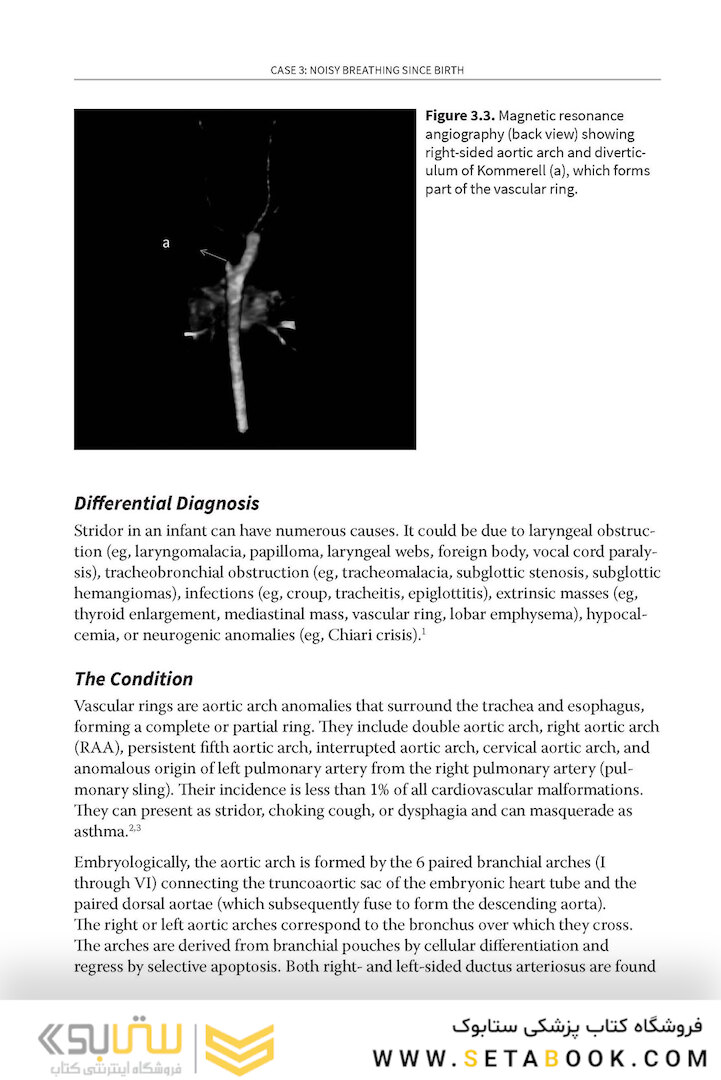 Challenging Cases in Neonatology: Cases from NeoReviews Index of Suspicion in the Nursery and Visual Diagnosis  First Edition 2019