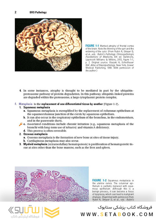 BRS Pathology (Board Review Series) Fifth, North American Edition