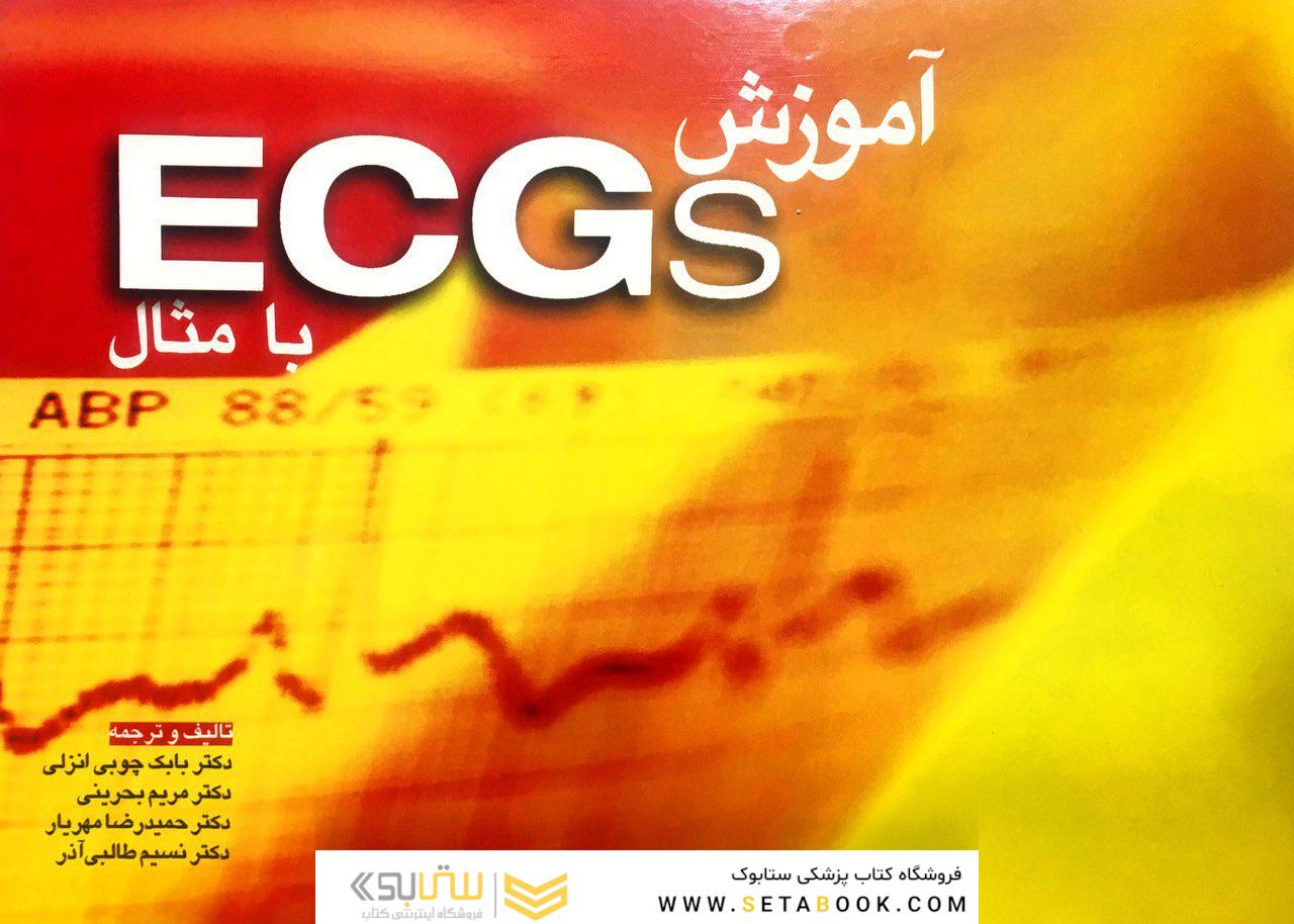 آموزش ECGs با مثال