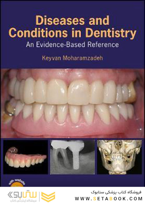 Diseases and Conditions in Dentistry: An Evidence-Based Reference 1st Edition 2018  بیماریها و شرایط در دندانپزشکی: یک مرجع مبتنی بر شواهد