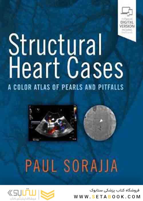 کتاب موارد قلبی ساختاری: اطلس رنگی مرواریدها و گودالها Structural Heart Cases: A Color Atlas of Pearls and Pitfalls 1st Edition 2019