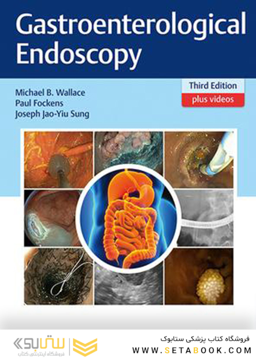 Gastroenterological Endoscopy 3rd edition Edition 2018 آندوسکوپی دستگاه گوارش 