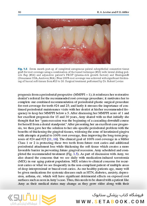  Advances in Periodontal Surgery: A Clinical Guide to Techniques and Interdisciplinary Approaches 1st ed. 2020 Edition پیشرفت در جراحی پریودنتال: راهنمای بالینی تکنیک ها و رویکردهای بین رشته ای