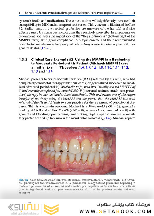  Advances in Periodontal Surgery: A Clinical Guide to Techniques and Interdisciplinary Approaches 1st ed. 2020 Edition پیشرفت در جراحی پریودنتال: راهنمای بالینی تکنیک ها و رویکردهای بین رشته ای