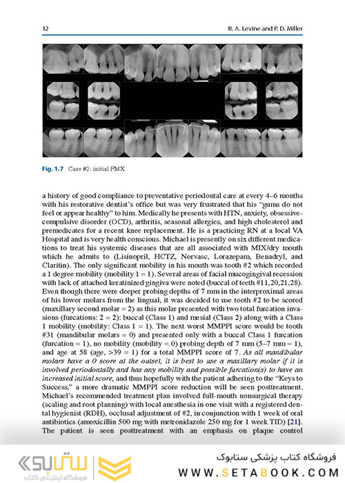  Advances in Periodontal Surgery: A Clinical Guide to Techniques and Interdisciplinary Approaches 1st ed. 2020 Edition پیشرفت در جراحی پریودنتال: راهنمای بالینی تکنیک ها و رویکردهای بین رشته ای