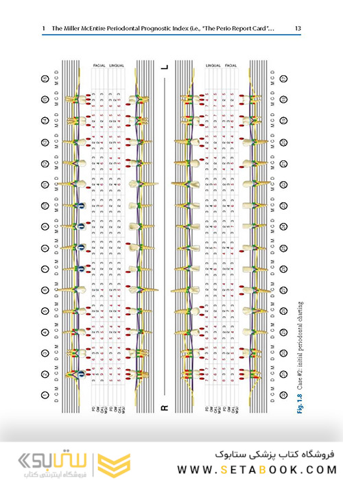  Advances in Periodontal Surgery: A Clinical Guide to Techniques and Interdisciplinary Approaches 1st ed. 2020 Edition پیشرفت در جراحی پریودنتال: راهنمای بالینی تکنیک ها و رویکردهای بین رشته ای