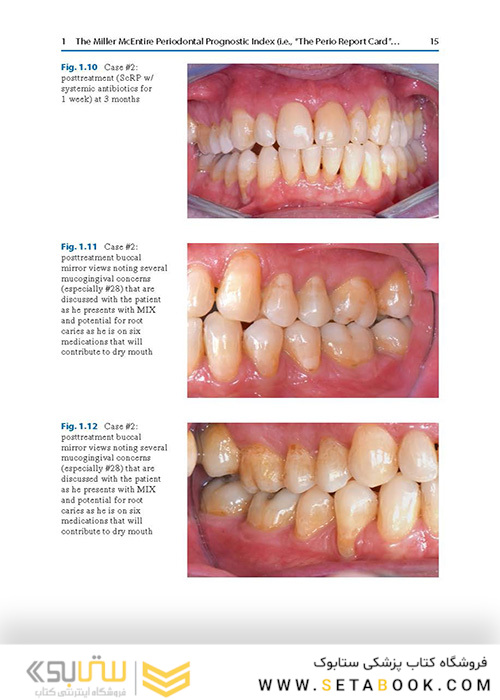  Advances in Periodontal Surgery: A Clinical Guide to Techniques and Interdisciplinary Approaches 1st ed. 2020 Edition پیشرفت در جراحی پریودنتال: راهنمای بالینی تکنیک ها و رویکردهای بین رشته ای