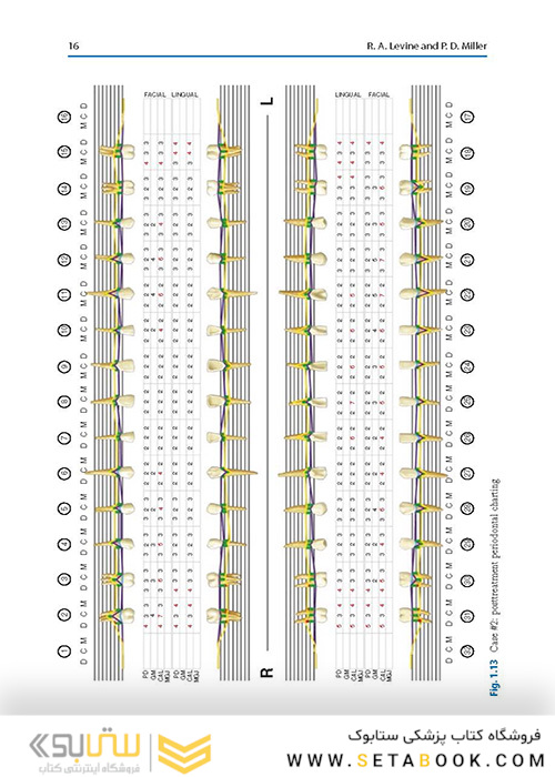  Advances in Periodontal Surgery: A Clinical Guide to Techniques and Interdisciplinary Approaches 1st ed. 2020 Edition پیشرفت در جراحی پریودنتال: راهنمای بالینی تکنیک ها و رویکردهای بین رشته ای