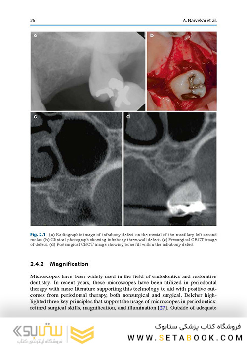  Advances in Periodontal Surgery: A Clinical Guide to Techniques and Interdisciplinary Approaches 1st ed. 2020 Edition پیشرفت در جراحی پریودنتال: راهنمای بالینی تکنیک ها و رویکردهای بین رشته ای